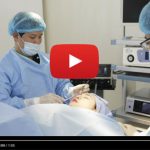 Bấm mí mắt không phẫu thuật – video thực hiện chi tiết